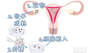 南京鼓楼医院做三代试管婴儿可以选性别生男生女吗？