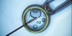 ​山西捐卵试管的最新版费用公开，附2022年第三代供卵试管生男孩过程解读