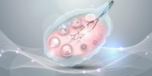 试管婴儿冷冻胚胎到期不续费会怎么样？