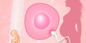 输卵管堵塞是手术还是直接试管？