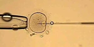 因子宫内膜问题不能受孕的，生殖科会要求调理好再移植
