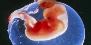 5cb囊胚质量一般也有存在意义，移植前注意调理好身体