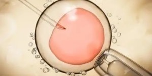 宫腔粘连怀孕了对胎儿有影响吗 要注意哪些问题