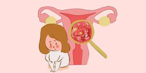 有子宫肌瘤是留还是不留？会影响到女性生育能力吗？