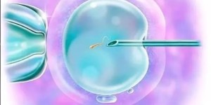 胎儿9号染色体缺失后果，生出来的宝宝会怎么样？
