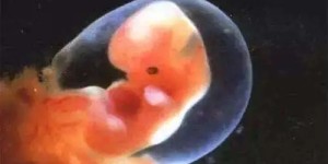 胚胎等级5bb什么意思 如何提高胚胎质量