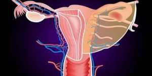 子宫腺肌症最怕三种运动是哪些？子宫腺肌症要如何治疗？