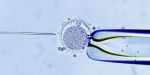 胚胎移植腹水有哪些症状