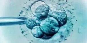 2022年吉大二院做试管婴儿冻胚移植一次大概费用要多少钱?