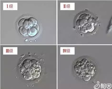 D3胚胎等级怎么分