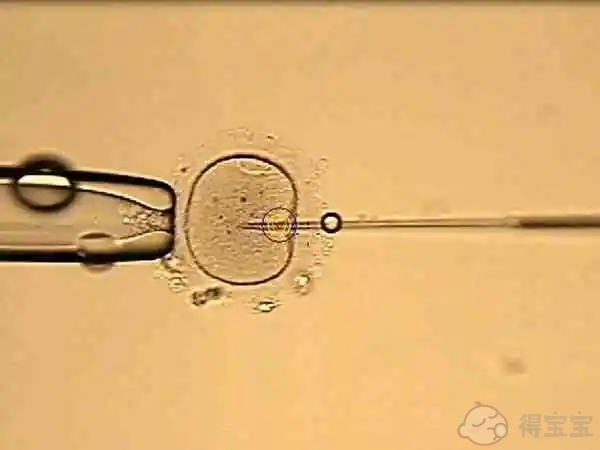 输卵管通液术当月可以怀孕吗 术前检查有哪些